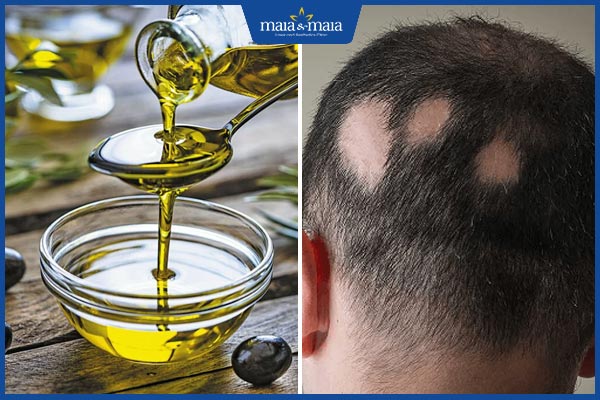 dầu oliu trị rụng tóc có tốt không