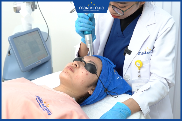 điều trị mụn nước ở mặt