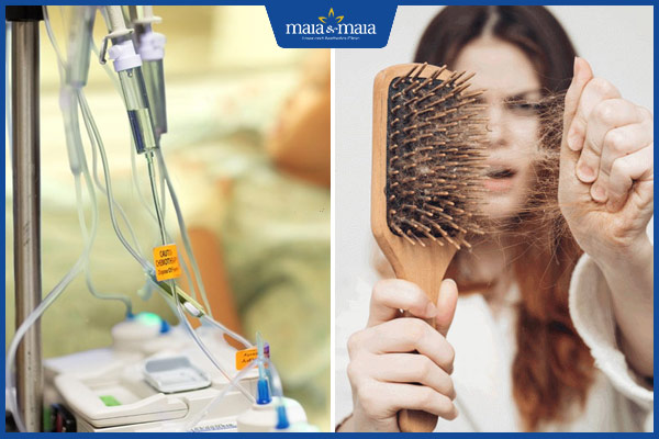 hóa trị rụng tóc