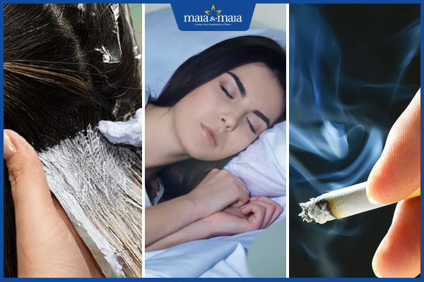 lý do tóc rụng bạc sớm