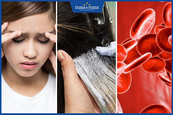 nguyên nhân gây rụng tóc sau sinh