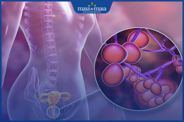 nhiếm nấm âm đạo