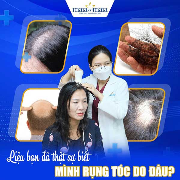 soi da đầu