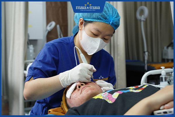 trị mụn công nghệ cao maia