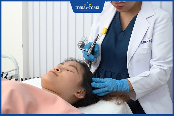 trị rụng tóc bằng maitrix hair