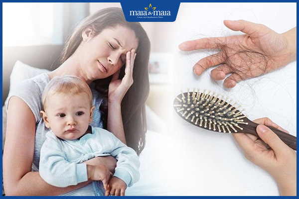 vấn đề rụng tóc sau sinh