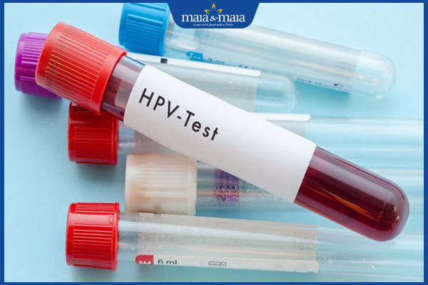 xét nghiệm hpv