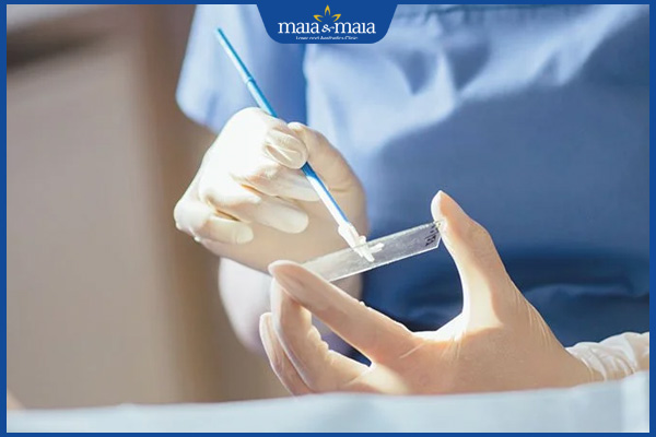 chẩn đoán sùi mào gà