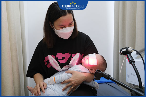 chữa mụn sữa cho trẻ em