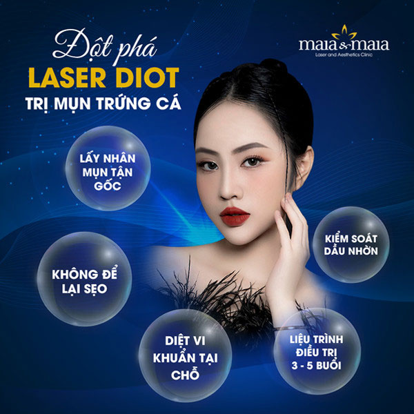 công nghệ laser diot