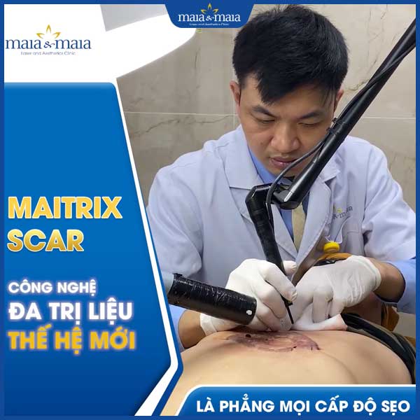 công nghệ maitrix scar