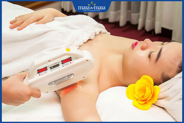 công nghệ triệt lông bằng ánh sáng
