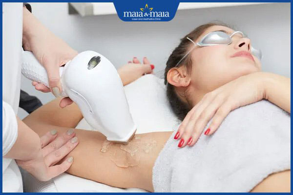 kỹ thuật triệt lông vĩnh viễn