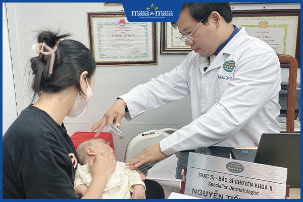 trẻ khám mụn sữa tại nhà