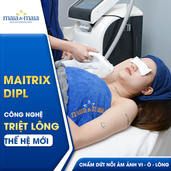 công nghệ triệt lông DiPL