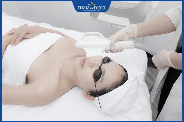 đánh bay nám bằng công nghệ IPL