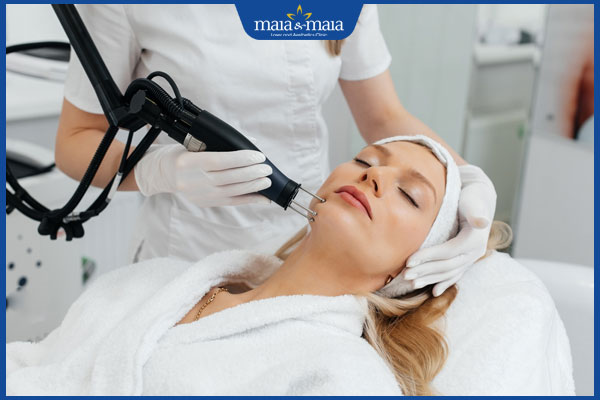 điều trị nám bằng laser