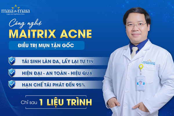 trị mụn bằng maitrix acne