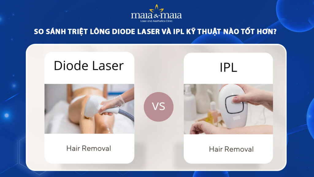 triệt lông Diode Laser và IPL