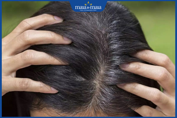 thiếu máu gây rụng tóc