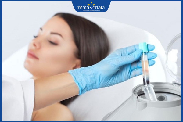 quy trình tiêm prp trị nám