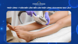 triệt lông 1 tuần mấy lần
