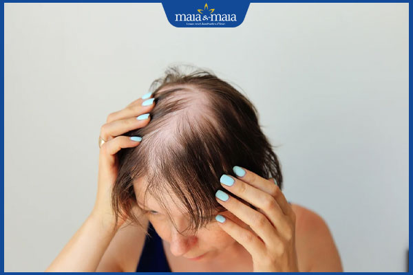 bị rụng tóc