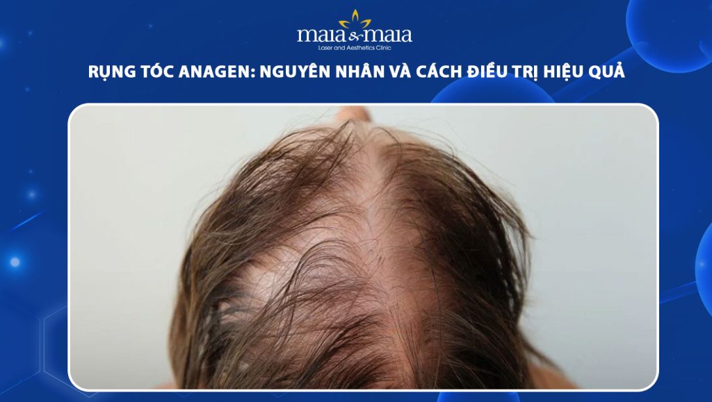 Rụng tóc anagen: Nguyên nhân và cách điều trị hiệu quả 1 rụng tóc anagen
