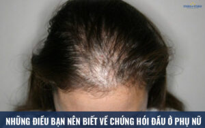 d5e4695cb035426b1b24