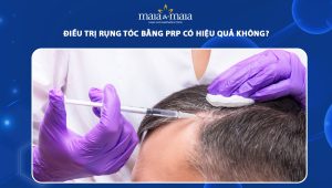 điều trị rụng tóc bằng prp có hiệu quả không