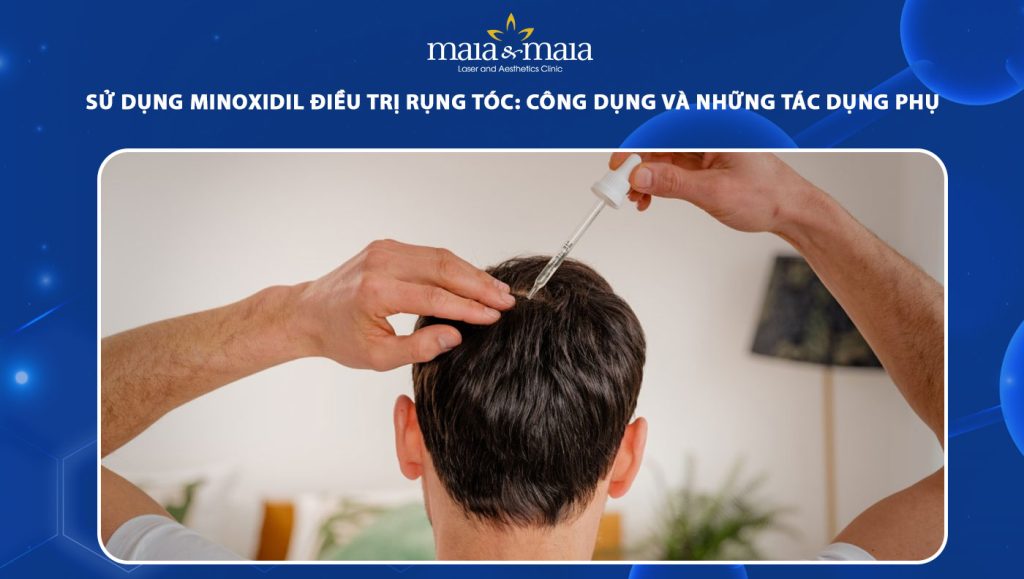 minoxidil điều trị rụng tóc