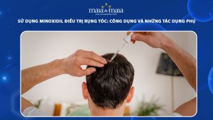 minoxidil điều trị rụng tóc