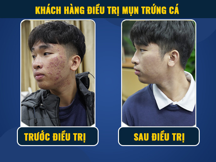 anh dich vu 10