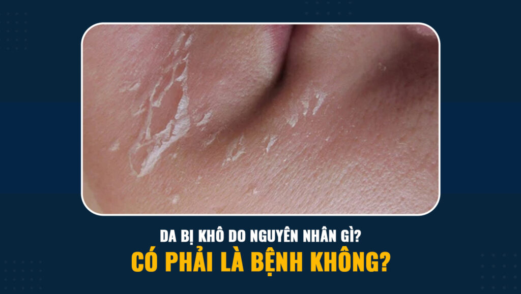da bi kho 5