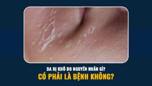 da bi kho 5