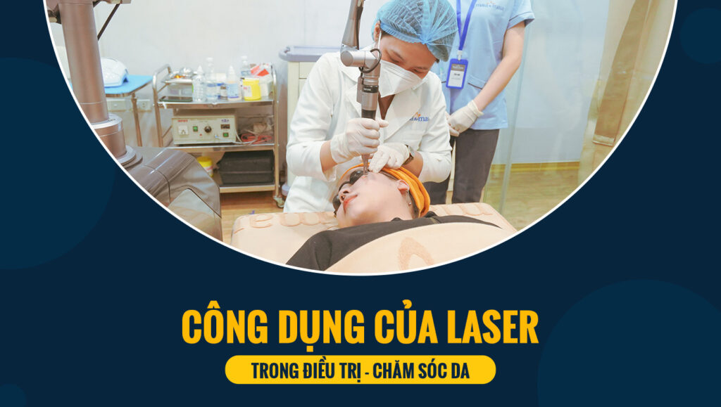 cong dung cua laser 8