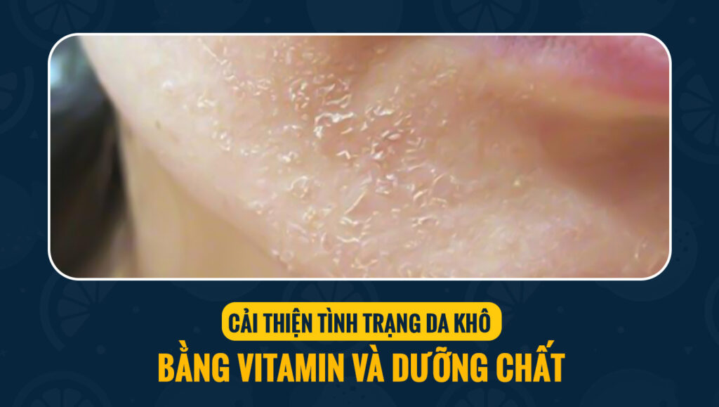 cai thien tinh trang kho da 5