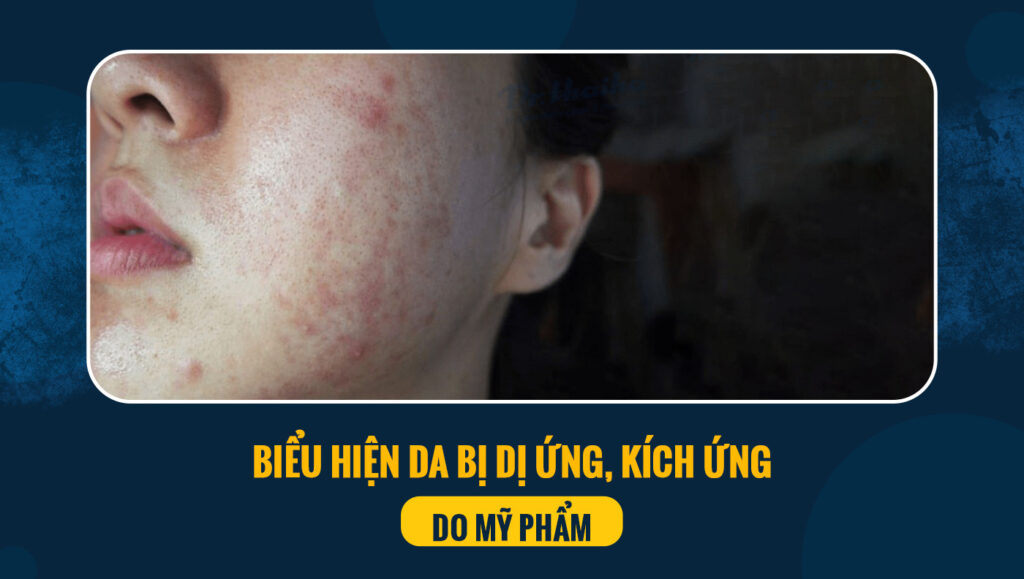 kich ung da do my pham 4