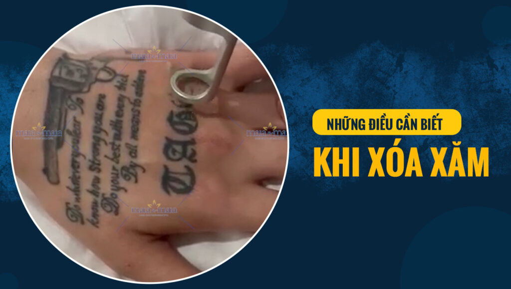 xoa xam 3