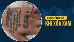 xoa xam 3