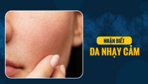 nhan biet da nhay cam 1