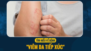 viem da tiep xuc 7