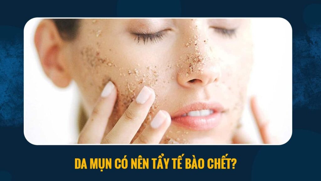 Da mụn có nên tẩy tế bào chết