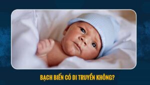 bạch biến có di truyền không
