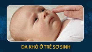 da khô ở trẻ sơ sinh