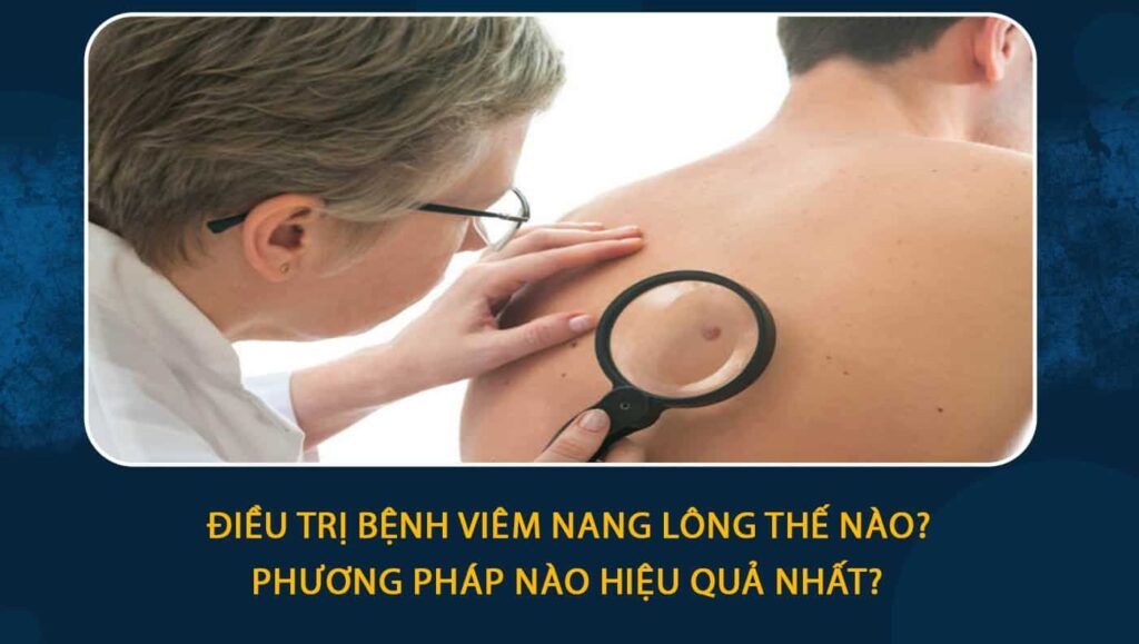 điều trị bệnh viêm nang lông