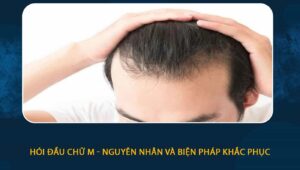 hói đầu chữ m