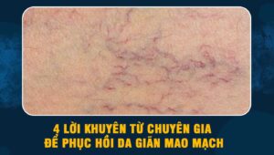 phục hồi da giãn mao mạch