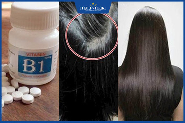 Kích thích mọc tóc bằng vitamin b1 có thật sự hiệu quả?