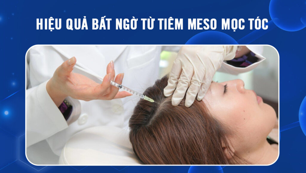 tiem-meso-moc-toc